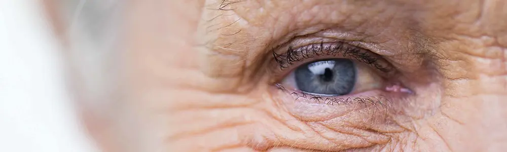 cataract-surgery-in-forster-nsw